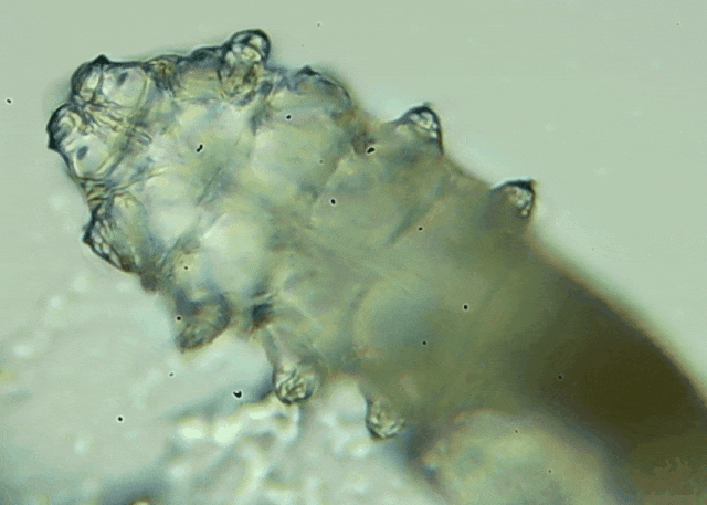 睫毛上驚現(xiàn)80只螨蟲！別揉了，快自查下你的眼睛有沒有......